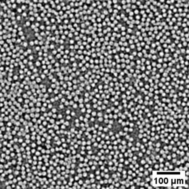 Enlarged image of  the tomogram of transmission image