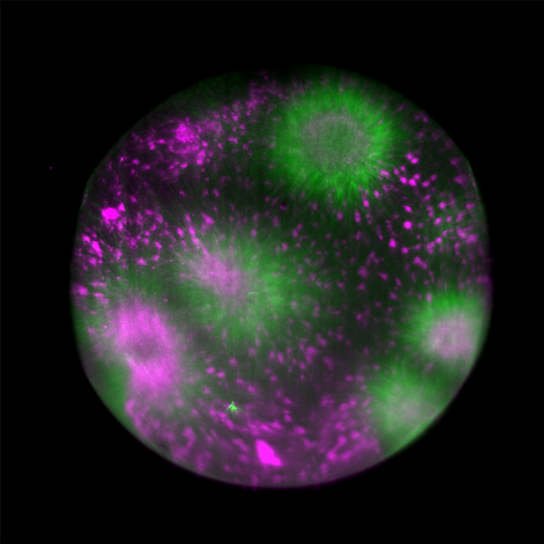 Tubulin assembly in cytoplasmic droplet
