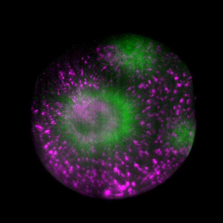 Tubulin assembly in cytoplasmic droplet
