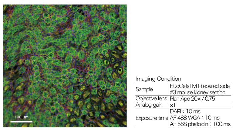Measurement Examples: mouse kidney