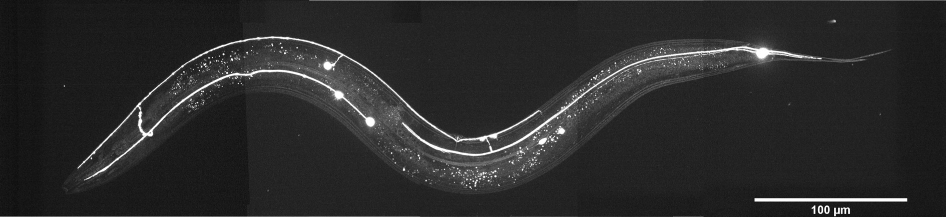 Caenorhabditis elegans