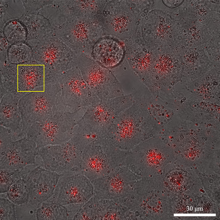 HeLa細胞における明視野像とFNDの蛍光像