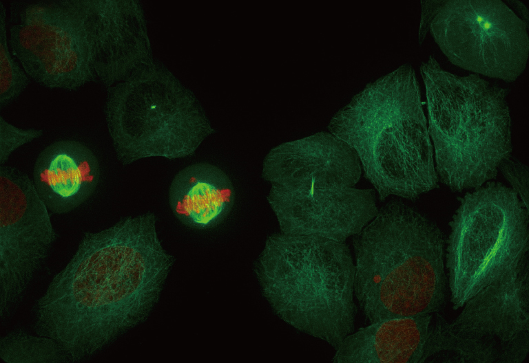 超解像画像 ORCA-Quest