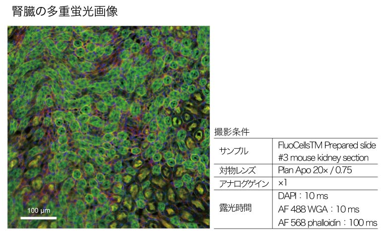 腎臓の多重蛍光画像